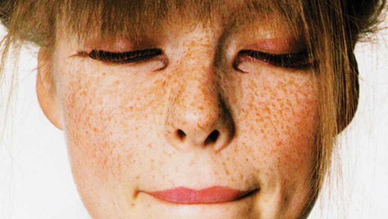 beauty, scin care, dark spots