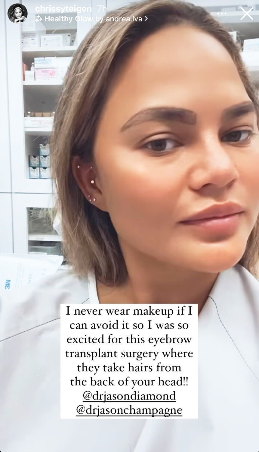 chrissy teigen eyebrows